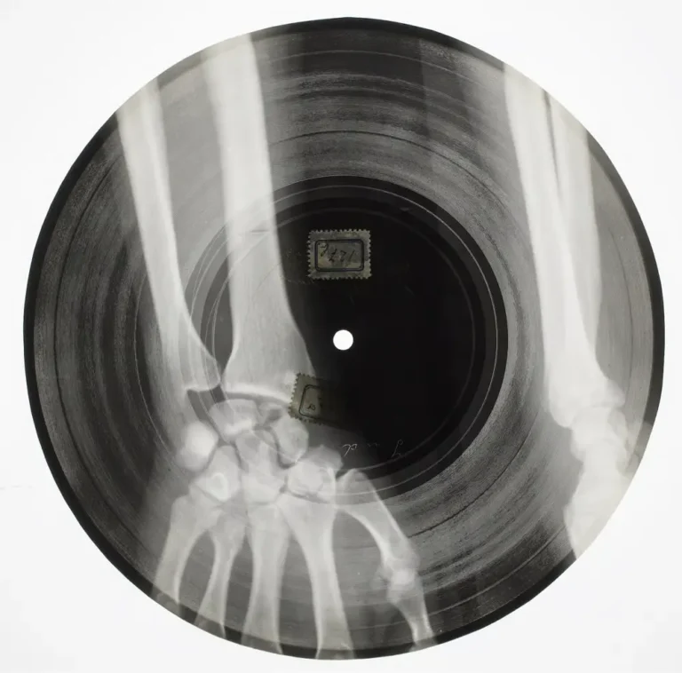 Before Dubplates There Were Bones: The Soviet X-Ray Vinyl Story