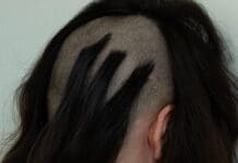 Skrillex Drops New Surprise Album – SOMA